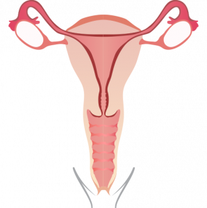 Лечение гинекологических заболеваний